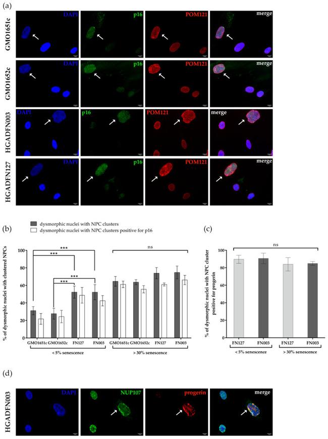 NUP107 Antibody in Immunocytochemistry (ICC/IF)