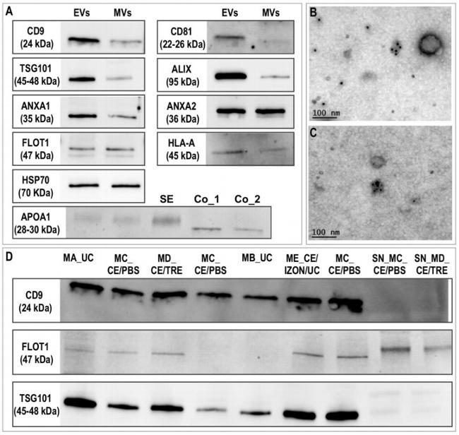 TSG101 Antibody in Western Blot (WB)