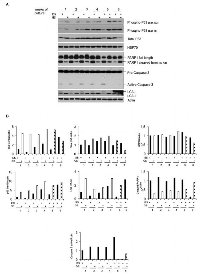 LC3B Antibody in Western Blot (WB)