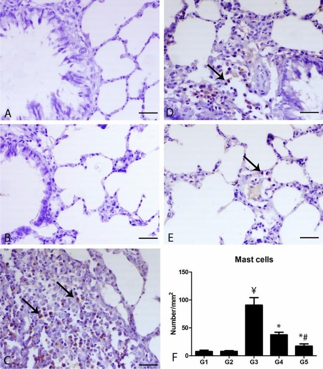 c-Kit Antibody in Immunohistochemistry (IHC)