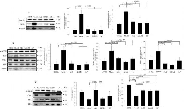 FASN Antibody in Western Blot (WB)