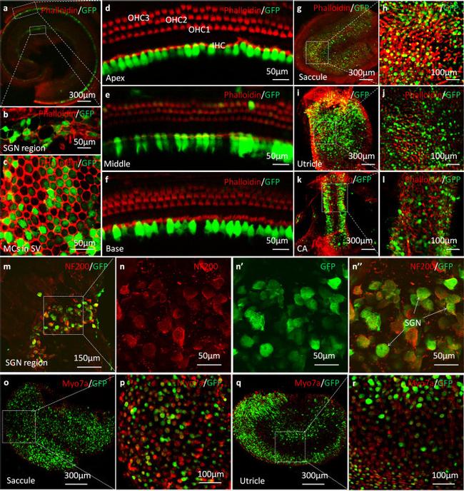 GFP Antibody in Immunohistochemistry (IHC)