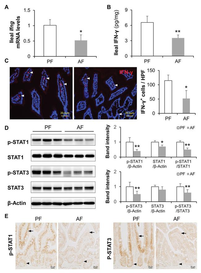 IFN gamma Antibody in Immunohistochemistry (IHC)