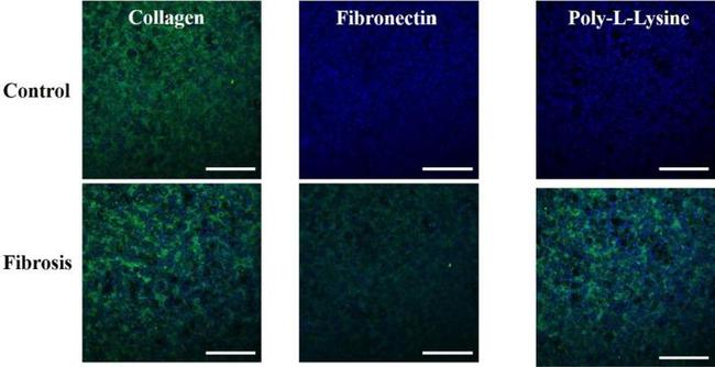 Collagen I Antibody in Immunocytochemistry (ICC/IF)