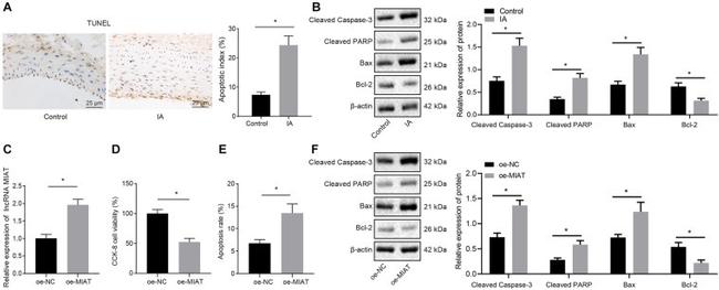 PARP1 (cleaved Asp214, Asp215) Antibody in Western Blot (WB)