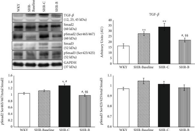 SMAD2 Antibody in Western Blot (WB)