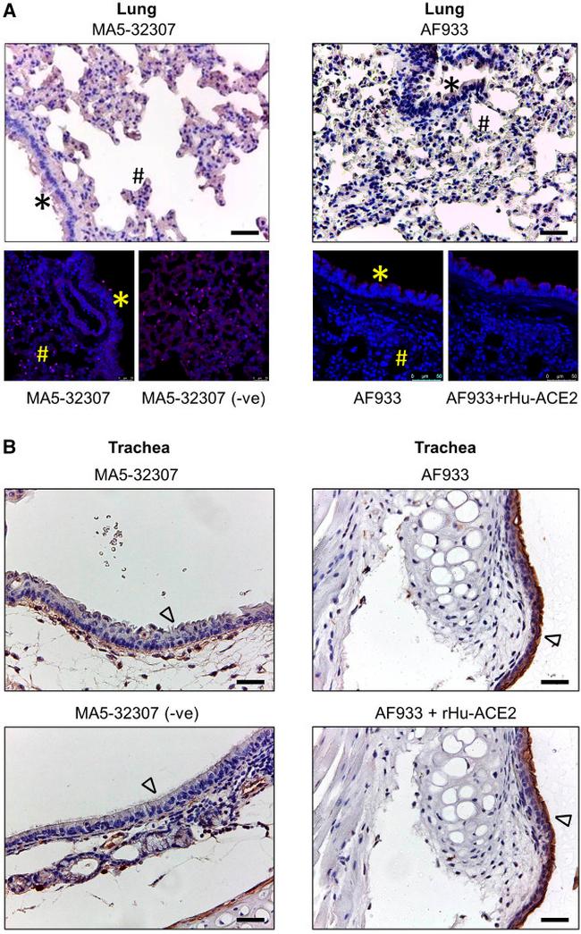 ACE2 Antibody in Immunohistochemistry (IHC)