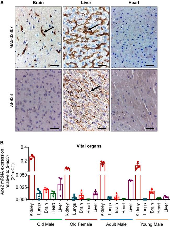 ACE2 Antibody in Immunohistochemistry (IHC)