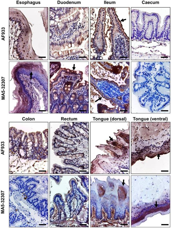 ACE2 Antibody in Immunohistochemistry (IHC)