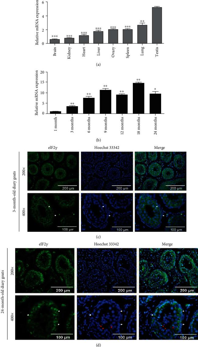 eIF2 gamma Antibody in Immunohistochemistry (IHC)