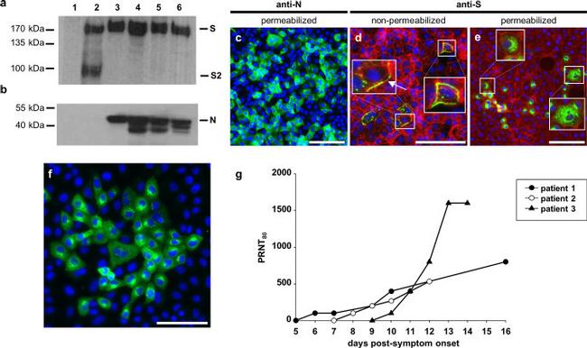 SARS Coronavirus Spike Protein Antibody in Western Blot (WB)