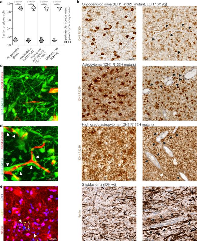 CD31 Antibody in Immunohistochemistry (IHC)