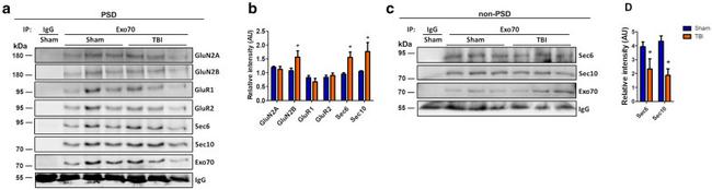 NMDAR2B Antibody in Western Blot (WB)