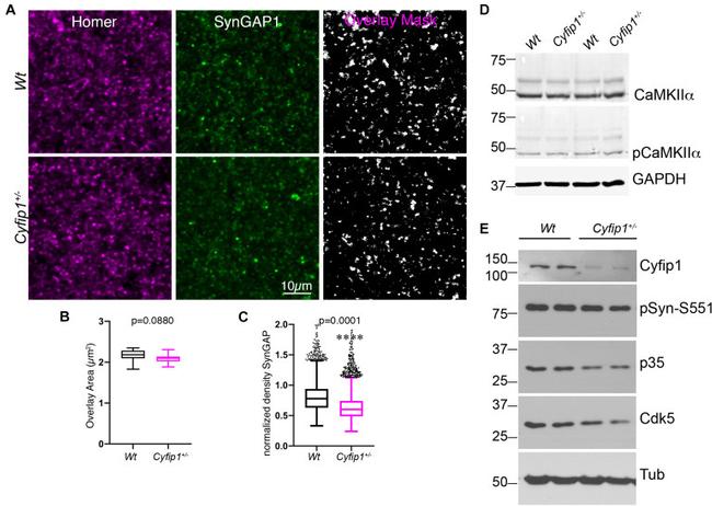 SynGAP Antibody in Immunohistochemistry (IHC)