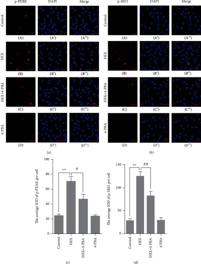 Phospho-IRE1 alpha (Ser724) Antibody in Immunocytochemistry (ICC/IF)