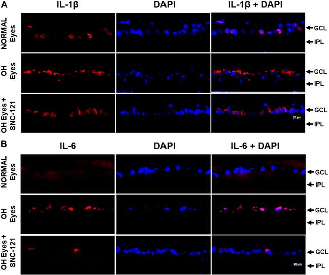 IL-6 Antibody in Immunohistochemistry (IHC)