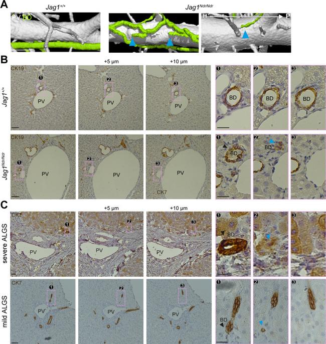 Cytokeratin 7 Antibody in Immunohistochemistry (IHC)