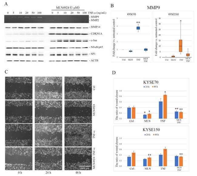 MMP14 Antibody in Western Blot (WB)