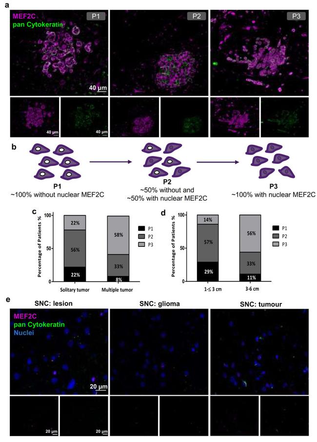 MEF2C Antibody in Immunohistochemistry (IHC)