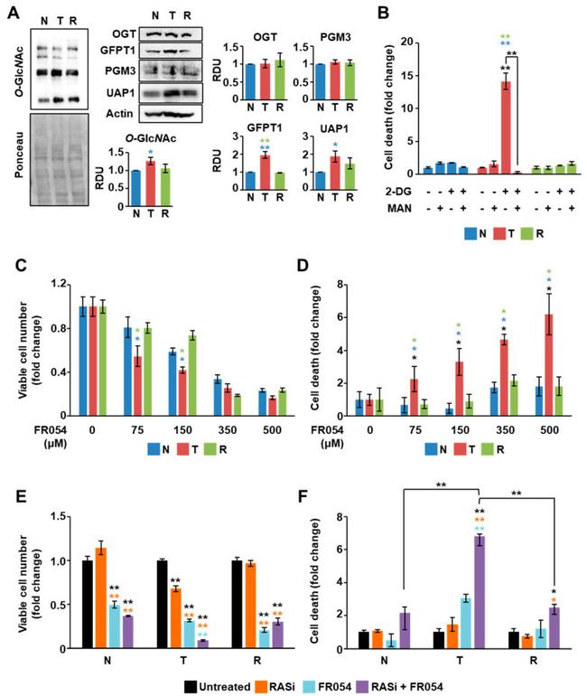 O-linked N-acetylglucosamine (O-GlcNAc) Antibody in Western Blot (WB)