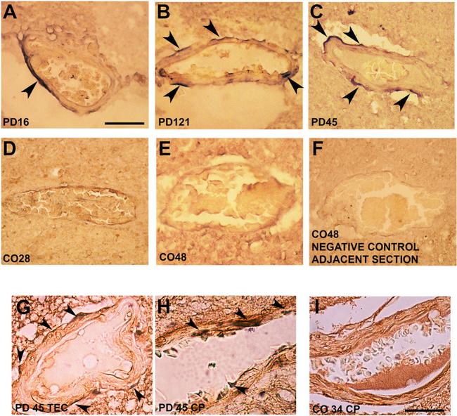 alpha Synuclein Antibody in Immunohistochemistry (IHC)