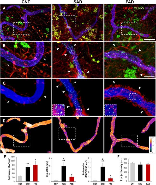 GFAP Antibody in Immunohistochemistry (IHC)