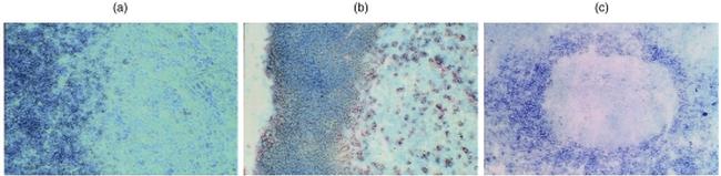 CD1d Antibody in Immunohistochemistry (IHC)