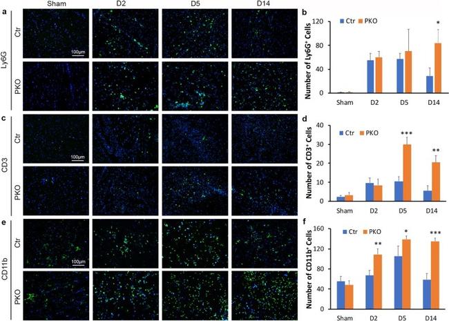 CD3 Antibody in Immunohistochemistry (IHC)