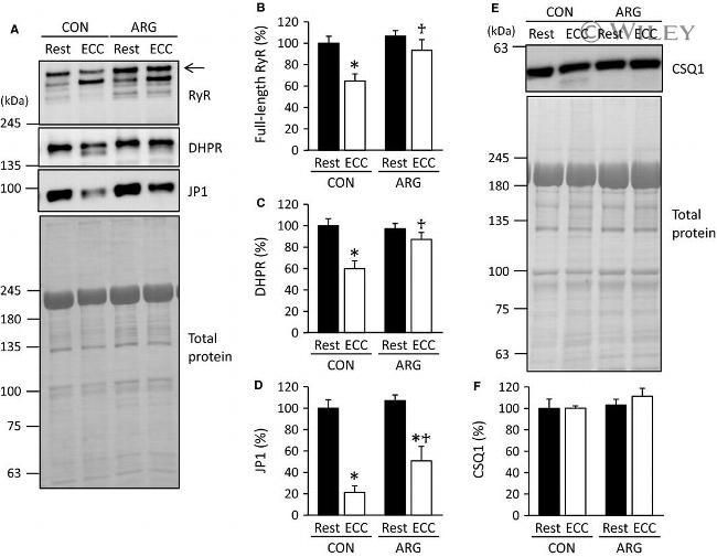 CaV1.1 Antibody in Western Blot (WB)