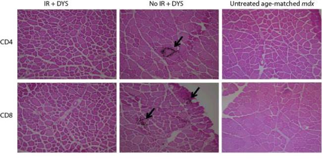 CD4 Antibody in Immunohistochemistry (IHC)