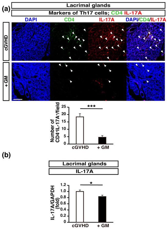 CD4 Antibody in Immunohistochemistry (Frozen) (IHC (F))