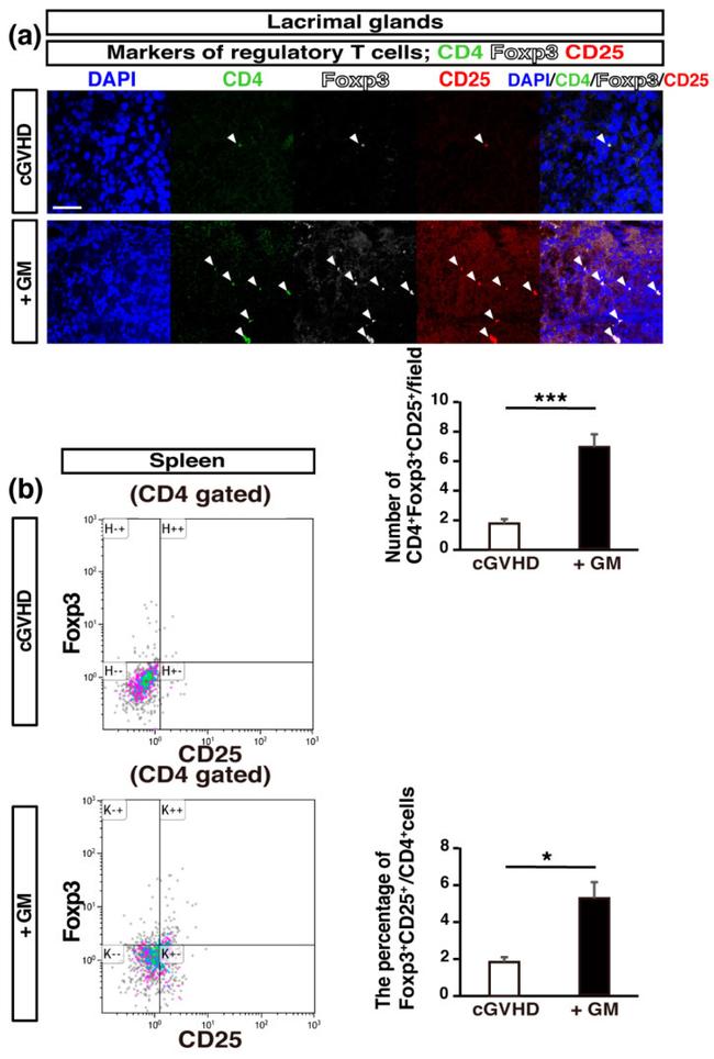 CD25 Antibody in Immunohistochemistry (IHC)