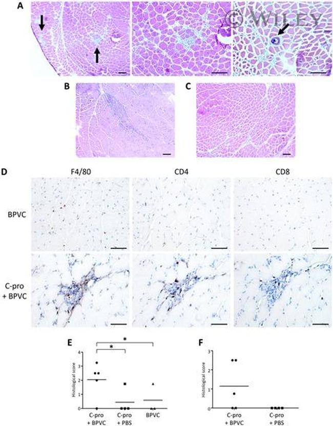 CD8a Antibody in Immunohistochemistry (IHC)