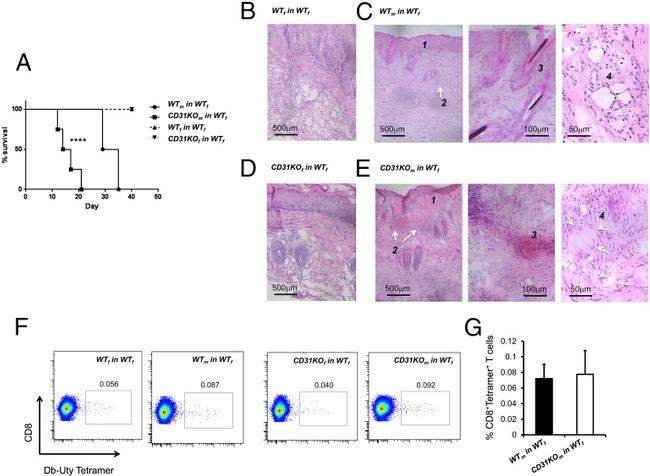 CD8a Antibody in Immunohistochemistry (IHC)