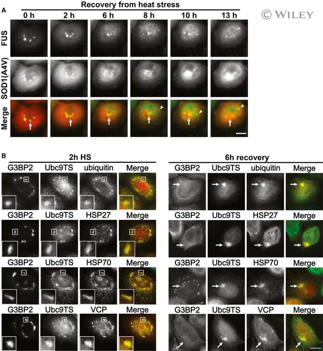 VCP Antibody in Immunocytochemistry (ICC/IF)