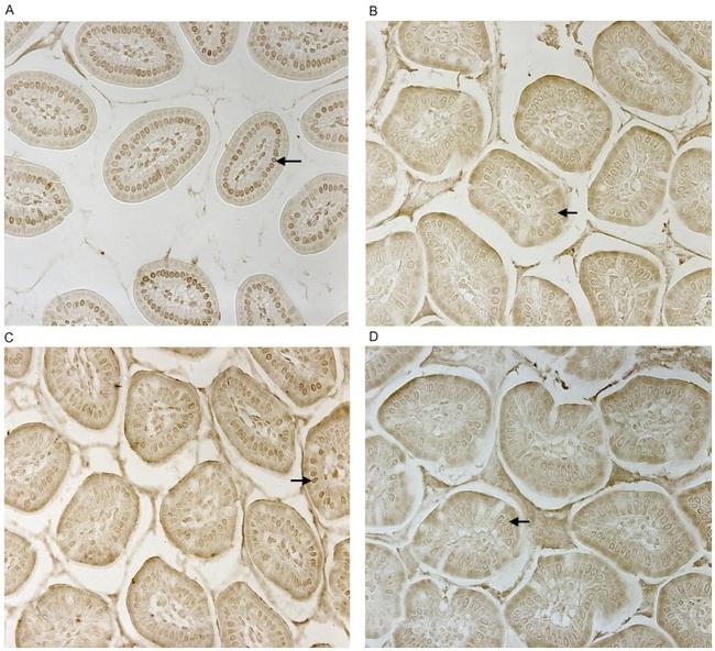 CD14 Antibody in Immunohistochemistry (IHC)