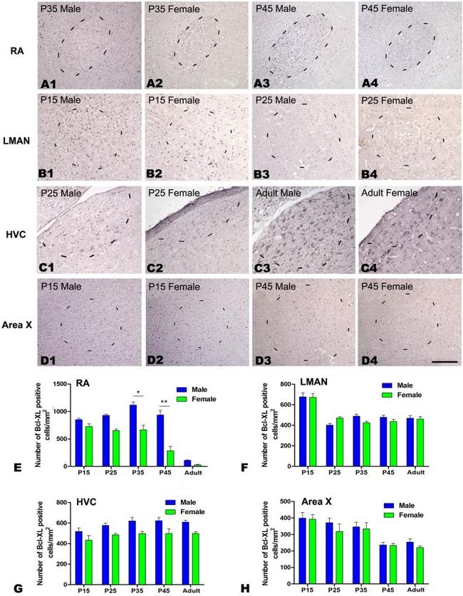 CD20 Antibody in Immunohistochemistry (IHC)