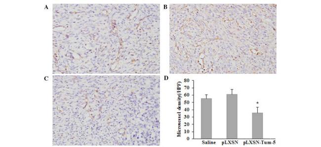 CD31 (PECAM-1) Antibody in Immunohistochemistry (IHC)