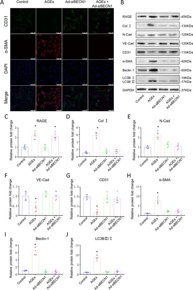 Alpha-Smooth Muscle Actin Antibody in Immunocytochemistry (ICC/IF)