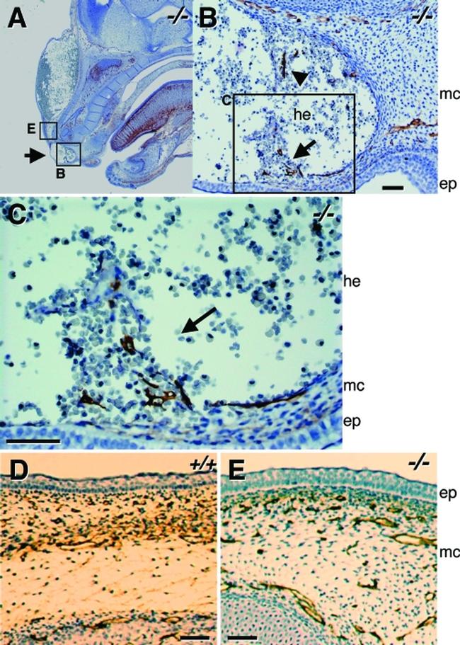 CD34 Antibody in Immunohistochemistry (IHC)