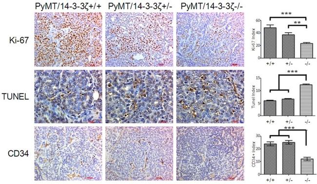 CD34 Antibody in Immunohistochemistry (IHC)