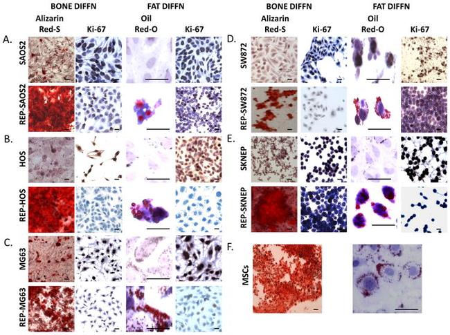 CD36 Antibody in Immunohistochemistry (IHC)