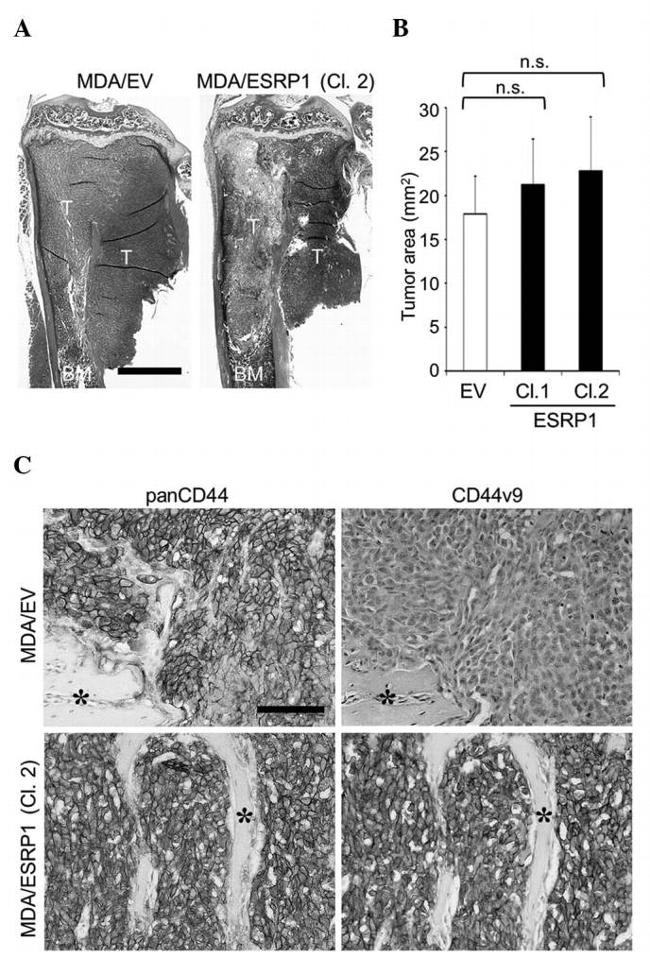 CD44 Antibody in Immunohistochemistry (IHC)