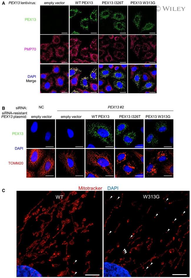 PMP70 Antibody in Immunocytochemistry (ICC/IF)