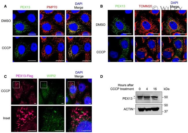 PMP70 Antibody in Immunocytochemistry (ICC/IF)