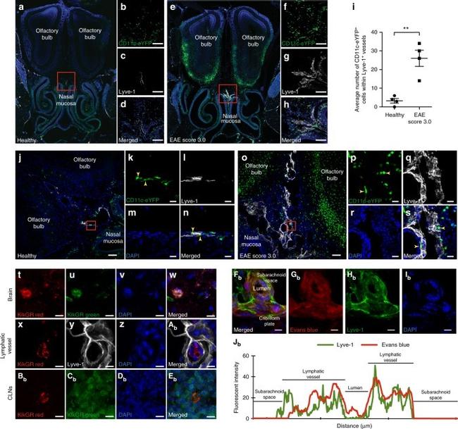 LYVE1 Antibody in Immunohistochemistry (IHC)