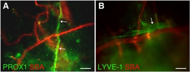 LYVE1 Antibody in Immunohistochemistry (IHC)