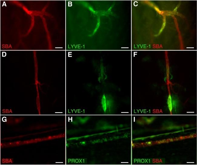 LYVE1 Antibody in Immunohistochemistry (IHC)