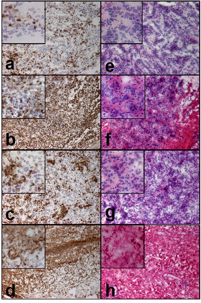 CD45 Antibody in Immunohistochemistry (IHC)