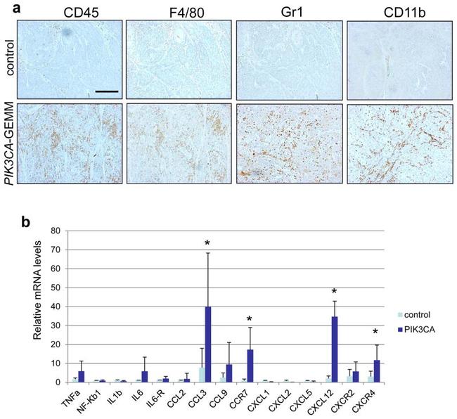 CD45 Antibody in Immunohistochemistry (IHC)